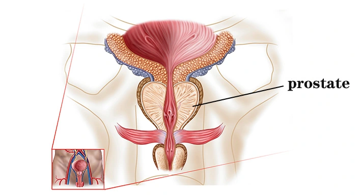 prostate.jpg