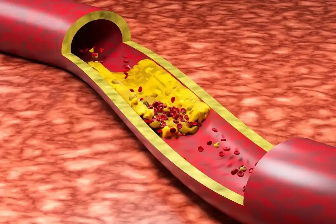 product-1-1 product-1-1