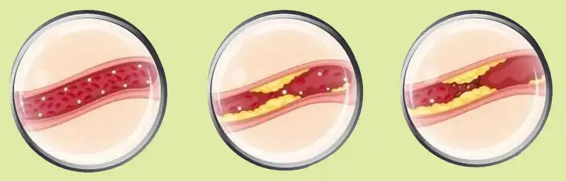 product-1-1 product-1-1