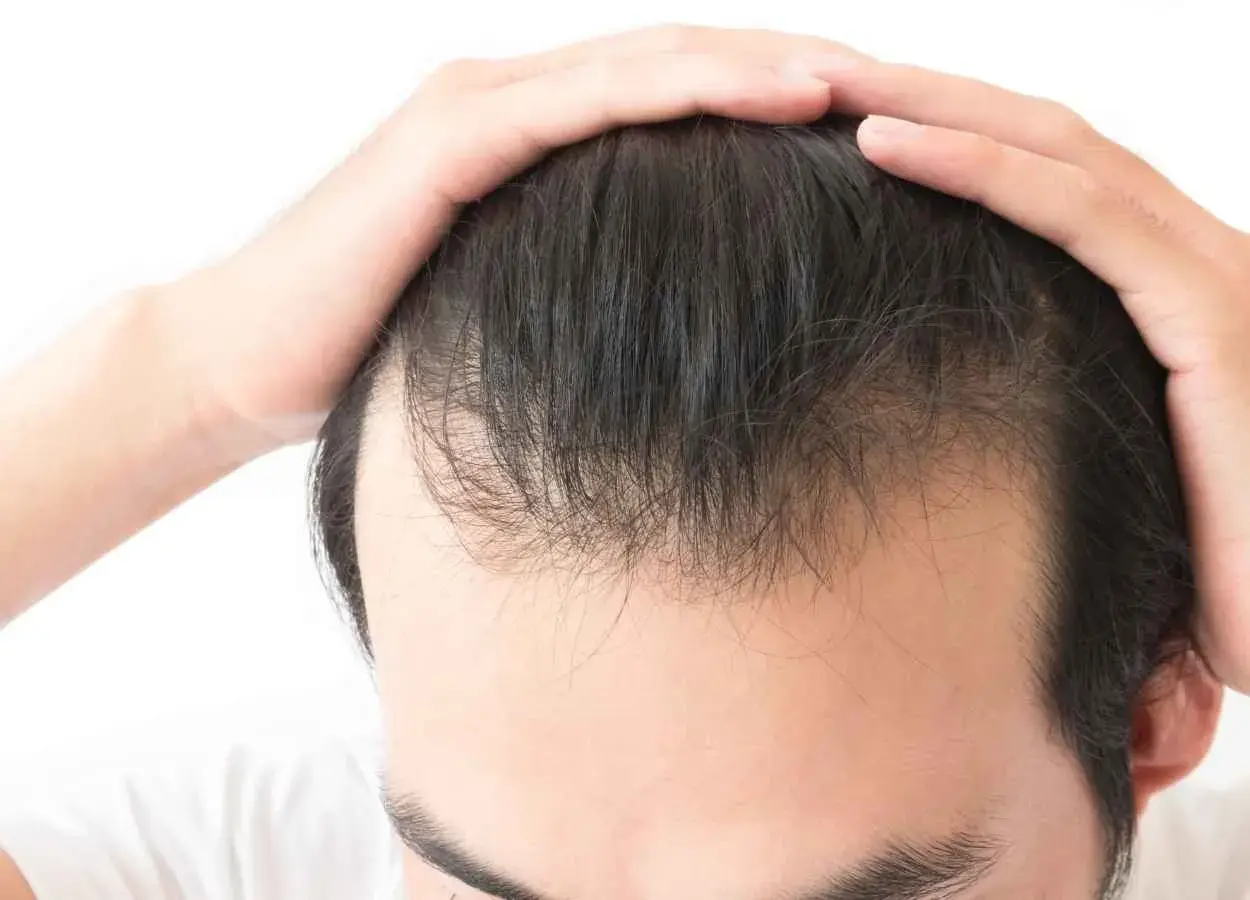 pyrrolidinyl-diaminopyrimidine-oxide-for-hair pyrrolidinyl-diaminopyrimidine-oxide-for-hair